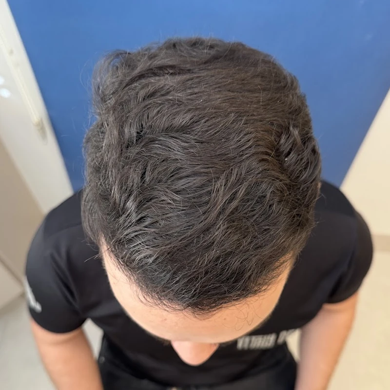 (01b) Antes e Depois_Personalizados_Site Clinica Sanabria copiar (01b) Antes e Depois_Personalizados_Site Clinica Sanabria copiar